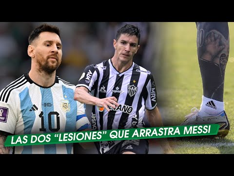 El GUIÑO de NACHO FERNÁNDEZ a RIVER + FUERTE CRÍTICA a MESSI + ¿Cómo está LEO?