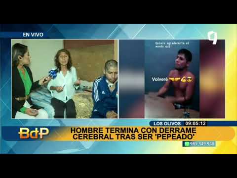 Los Olivos: hombre termina con derrame cerebral tras ser víctima de 'peperas'