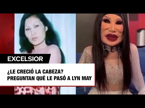 ¿Le creció la cabeza? Preguntan qué le pasó a Lyn May