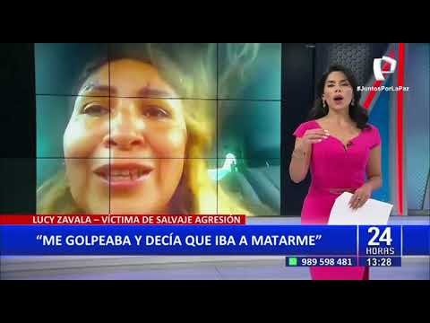 La desfiguran a días previos de su boda: mujer agrede brutalmente a dueña de hostal en Huaycán