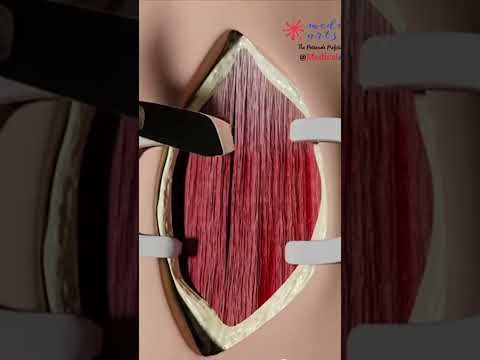 #human#vidio#vidioviral #trendingshorts #indian #vidios#youtube #trending