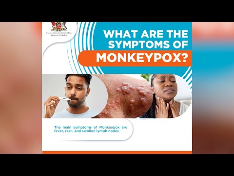 Third Case Of Monkeypox (Mpox) Recorded In T&T