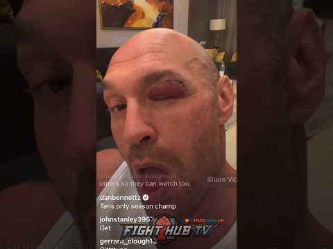 Tyson fury shows cut; announces new date for usyk fight!
