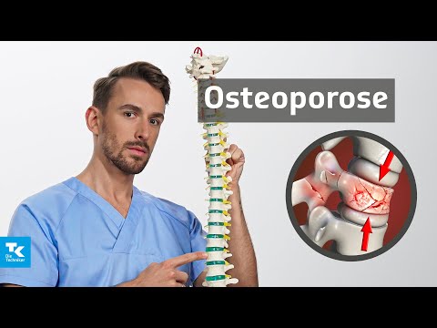 Osteoporose (Knochenschwund) | DocTommy