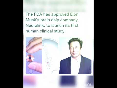 The FDA has approved Elon Musk’s brain chip company, Neuralink, to launch its first human clinical