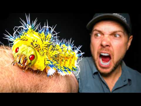 Electric Caterpillar Sting Test Gone Wrong!