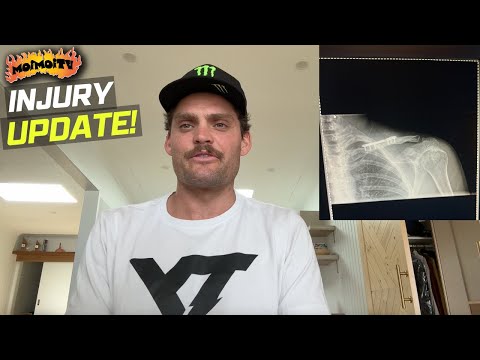 INJURY UPDATE | Jack Moir |