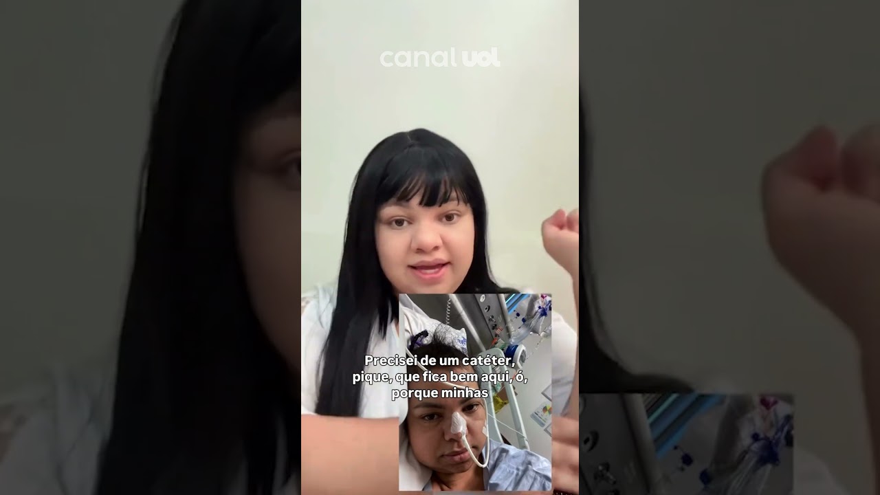 Mulher faz reversão de cirurgia bariátrica após chegar a pesar 32 kg veja vídeo