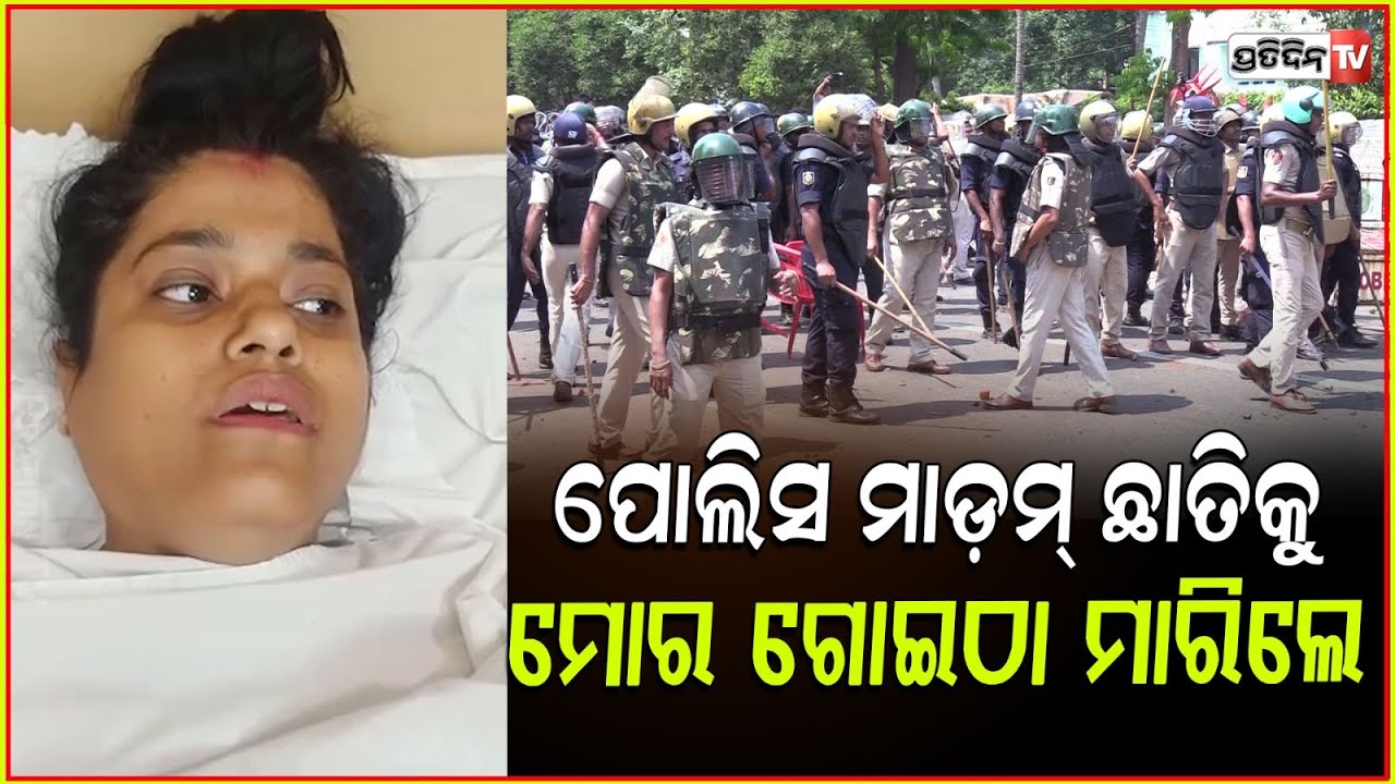 ମୋଟା ହେଇ ପୋଲିସ୍ ମାଡ଼ମ୍, ବାଡ଼ିରେ ମତେ ଘୋଷାଡି ନେଇଗଲେ। Injured Congress worker at hospital, Bbsr.