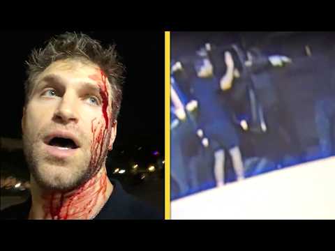 <strong>Pretty</strong> <strong>Little</strong> <strong>Liars</strong>’ Keegan Allen BLOODIED After Robbery at Gunpoint