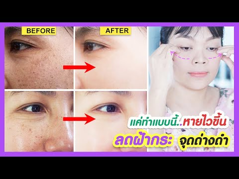 แค่ทำแบบนี้..หายเร็วขึ้น!!-วิธ แค่ทำแบบนี้..หายเร็วขึ้น!!-วิธ