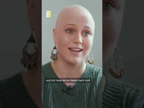 Alopecia: Julie fallen alle Haare aus #Alopecia #Haarausfall #Autoimmunerkrankung #trudoku #zdf