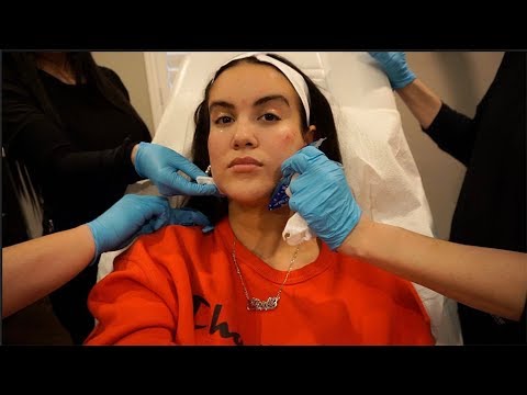 Yesterdays : Finally A Vlog | Fillers, More Piercings & Mexico