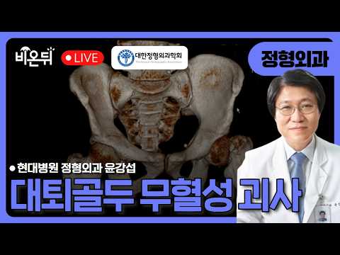 <strong>대퇴골두</strong> 무혈성 괴사 / 현대병원 정형외과 윤강섭 [대한정형외과학회]