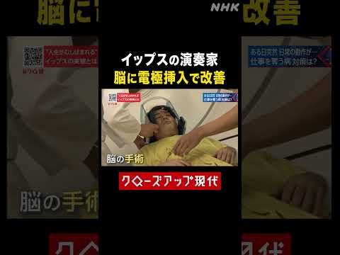 イップスに苦しむオーボエ奏者 脳の手術に密着【クロ現】| NHK | #shorts
