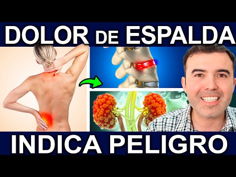 EL DOLOR DE ESPALDA INDICA PELIGRO  - Causas Alarmantes Del Dolor De Espalda Y Cómo Tratarlo