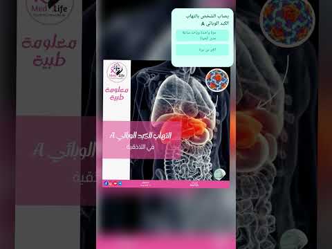 إعداد : نغم العك _ علوم صحية/الدكتورة مارلا صوايا#plasma_cell/#leukocyte#Med_life
