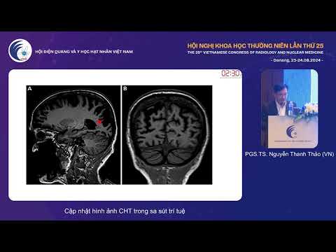 3. Cập nhật hình ảnh CHT trong sa sút trí tuệ (PGS.TS. Nguyễn Thanh Thảo)
