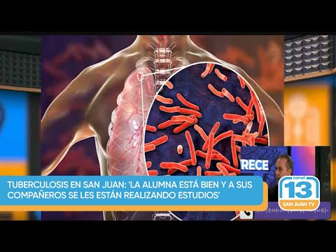 tuberculosis en San Juan: 'La alumna está bien y a sus compañeros se les están realizando estudios'