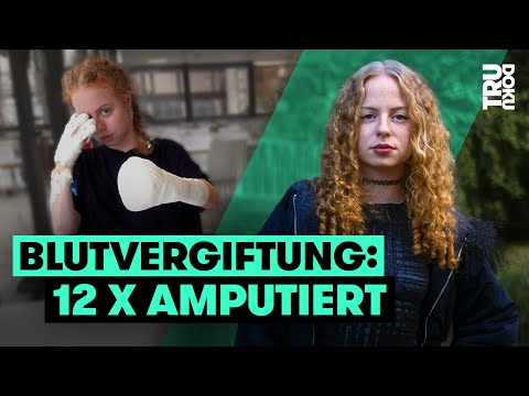 So lebt Justina ohne Finger und Unterschenkel | TRU DOKU