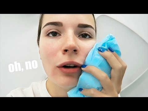 PULLING MY WISDOM TEETH *ow*