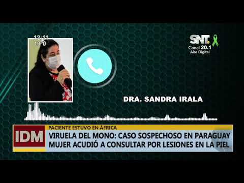 Sospecha de primer caso de viruela del mono en Paraguay.