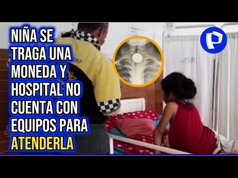 Iquitos: niña se traga una moneda de 1 sol y hospital no cuenta con equipos para atenderla