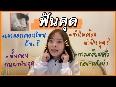 ฟันคุด…ทำไมต้องผ่า,เอาออกตอนไห