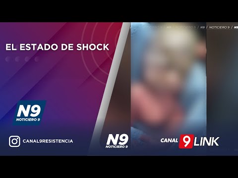 EL ESTADO DE SHOCK - NOTICIERO 9