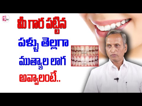 Teeth Whitening At Home || 100% EFFECTIVE Remedy In Telugu | Yellow Teeth NATURAL Remedy | SumanTv