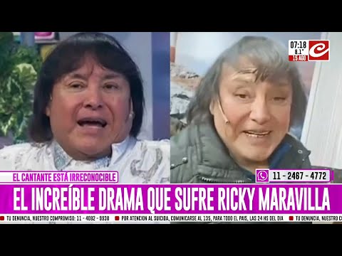 Ricky Maravilla se operó la cara... ¡y su celular no lo reconoce!