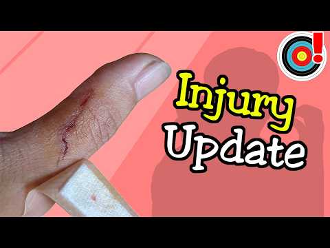 Thumb Injury Update