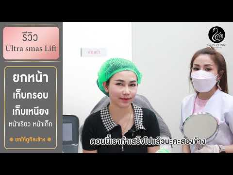 รีวิวUltraSmasLitfยกให้ดูท