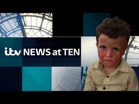 Watch ITV News at Ten as Gaza's sick children talk not of illness, but hunger in Jordan | ITV News