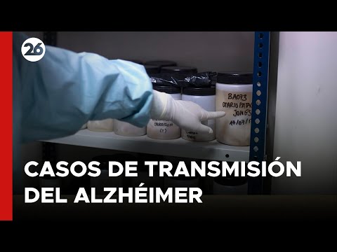 REINO UNIDO | Presuntos primeros casos de transmisión del Alzhéimer