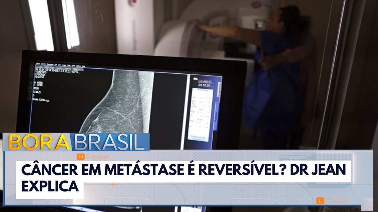 Câncer em metástase é reversível