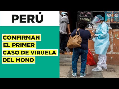 Viruela del Mono en Perú: Confirman el primer caso en ciudadano extranjero en el país