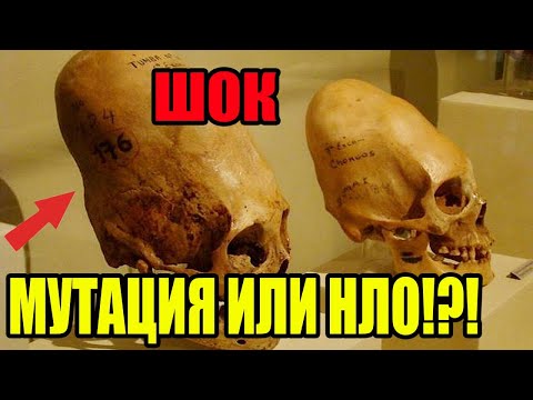
ТАИНСТВЕННЫЙ ИНЦИДЕНТ С НЛО В АНГЛИИ ОШАРАШИЛ ВЕСЬ МИР! ОЧЕВИДЦЫ ОНЕМЕЛИ ОТ СТР ХА!
