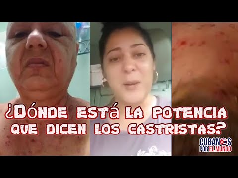 Cubana denuncia que su mamá tiene sarna noruega y le niegan atención médica dentro de la isla