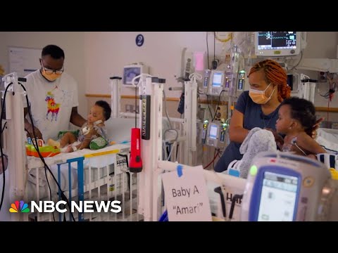 Surgeons in Philadelphia successfully separate conjoined twins