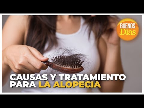Causas y tratamientos para la Alopecia - Dra. Lisbella Azuaje