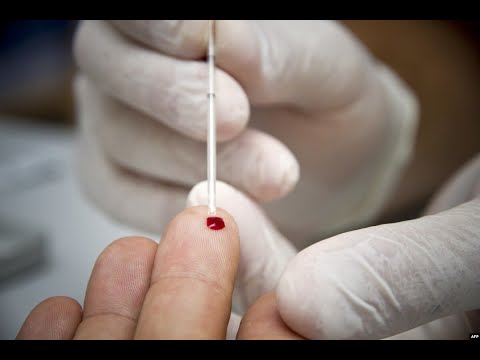 Info Martí | Estar enfermo de VIH en Cuba