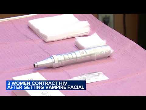 3 women diagnosed with HIV after getting vampire facial procedures