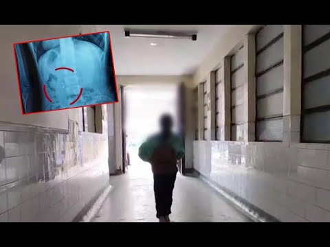 Bullying en Cusco: Escolares obligan a tragar grapa a su compañera