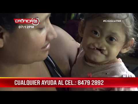 Madre con cáncer pide ayuda para su hija con labio leporino y paladar hendido - Nicaragua