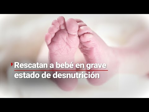 ¡Padres inhumanos! Encuentran a bebé de 2 meses en terribles condiciones