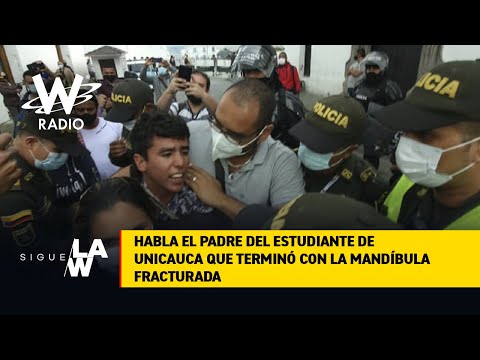 ¿Excesos de la Policía Estudiante de Unicauca terminó con la mandíbula fracturada