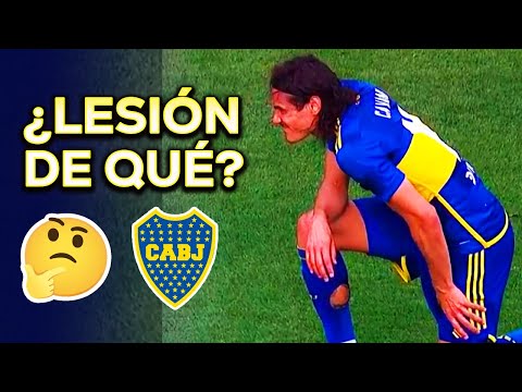 ¿CAVANI MIENTE O LLEGÓ MAL FÍSICAMENTE?  OTRA VEZ LESIONADO