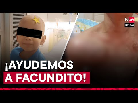 España: Niño peruano con cáncer hace pedido de ayuda para no perder el brazo