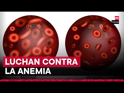 Anemia Materno Infantil: ¿qué estrategias aplicará el Minsa y el SNI para su reducción?